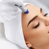 dermapen-1